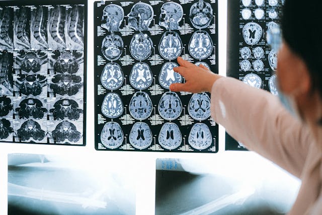 doctor pointing at brain scans